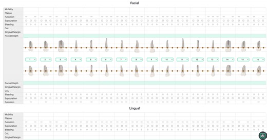 Voice Perio Charting – Hands-Free in Under 5 Min | Denti.AI
