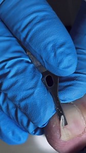 62K views · 160 reactions | Cut the nails in the right shape. #SelfCarePedicure #PedicureLove #FootCareSelfLove #RelaxationMode #PamperYourFeet #MindfulPedicure #WellnessWednesday #SelfCareSunday #BeautyAndTranquility #EmpoweredSelfCare #HealingVibesPedicure #SoulfulSelfCare #PedicureBliss #CalmingSelfCare #FeetFirstSelfCare #NourishYourSoul #PedicureTherapy #HolisticSelfCare #GlowingFeetHappyHeart #TranquilPedicureMoments | The Pedicure Queen | Facebook