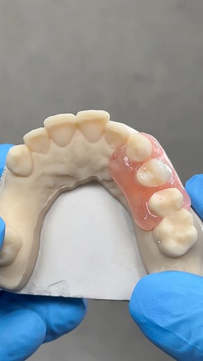 Flexible Nesbit! Case from Dr. Nicholas DiMauro in Massachusetts! EnvisionTEC Middleton Dental Care | Luke Kahng