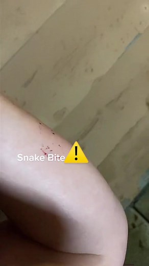 Glizzy bit me! #warning⚠️ #ballpython #snake #thelizardgang6 #reptile #snakebite #fypシ #viral #snakebite #pet #rat #warning #blood