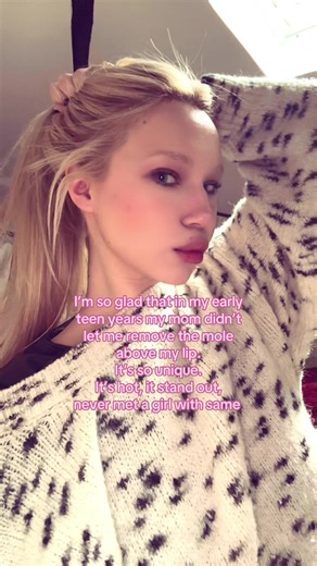 Embracing Unique Beauty: The Mole Above the Lip