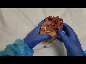 Heart Dissecting the Coronary Arteries