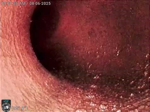 TSU condensate return line 2