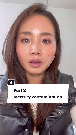 Mercury Detox Journey: Part 2 - Chelation Therapy Experience