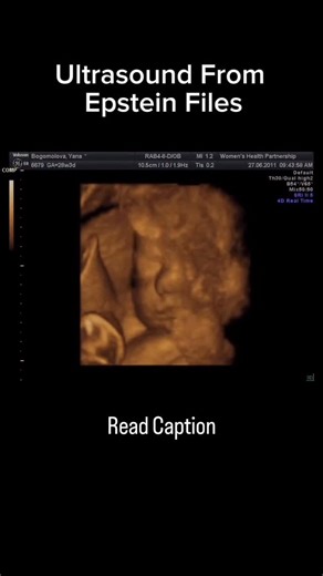 Justin | I’ve been able to determine additional details about the woman seen in the ultrasound, and her path into Jeffrey Epstein’s orbit appears to... | Instagram