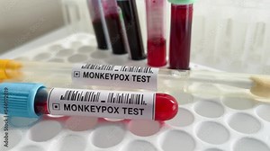 Samples and Test tubes for analysis and diagnostic of antigens and antibodies of monkeypox virus. Work table with equipment and samples for test of diagnosis of MPXV monkeypox or smallpox diseases