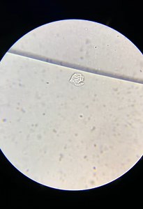 Tiny Things Revealed: Amazing Microscope Close-Ups!