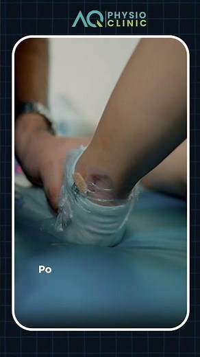 How to Bend Your Knee After ACL Surgery | Step-by-Step Recovery Guide by Physiotherapist#kneepain