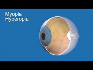 Myopia and Hyperopia