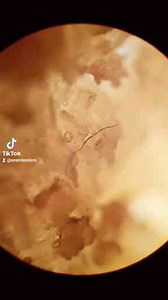 Microplastic in Fish Fingers – A Closer Look Under the Microscope