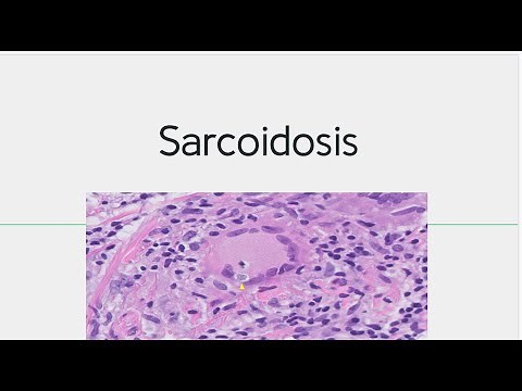 Sarcoidosis : Morphology, Pathogenesis