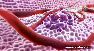 3D模拟癌细胞(3D Medical Animation - What is Cancer)