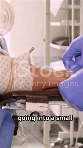 Master Central Line Placement in Minutes 2025 09 08 Part 1