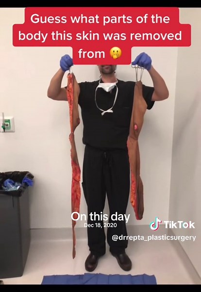 Mastopexy Information from New Orleans - Dec 18, 2020