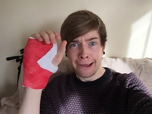 BROKEN HAND NEWS!!