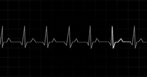 Ekg Heartbeat Reading Animation On Black Stock Motion Graphics SBV-352310226 - Storyblocks