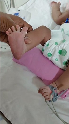 Babinski's Sign #Reflex #CNS #paediatrics #neonatology