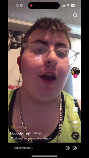 Getting myself some vampire teeth asap #fyp #foryou #foryourpage #viral #xyzbca