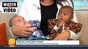 Twins born with completely different skin tones (GMB)