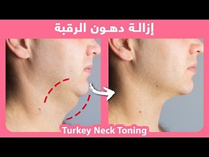 How to naturally tone turkey neck and reduce neck fat