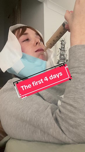 Jaw Surgery Recovery Update: Bruising, Swelling, and Mental Challenges