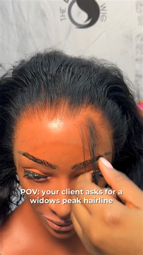 The Invisible Wig™ | A widow’s peak is when your hairline comes down into a little point in the middle of your forehead, instead of being straight across. It’s... | Instagram