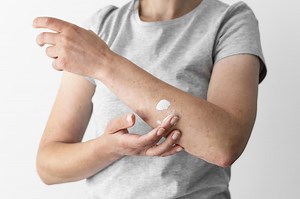 Infections fongiques : causes, symptômes, létalité et traitements