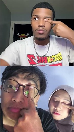 EYE PUPILS ARE NOT SYNCHRONIZED #duet #trending #try