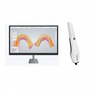 [Hot Item] Panda 3 Depth of Field 20 mm Dental Intraoral Scanner 3D with Multiple Scanner Tips Digital Dentistry Scanner Tool