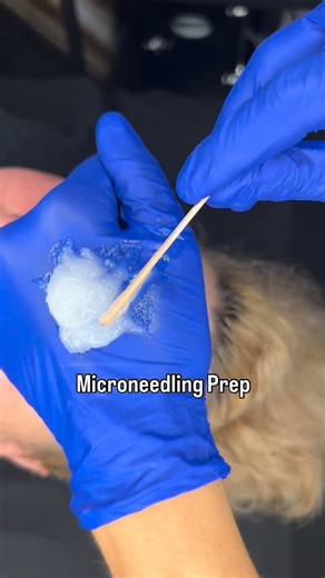 Microneedling: Microneedling is a skin treatment where tiny needles poke the surface of your skin to trick your body into making more collagen and elastin …the stuff that keeps your skin smooth, tight, and youthful. Think of it like this: you’re making tiny little controlled stabs so your skin heals itself stronger and better. It helps with acne scars, wrinkles, pores, texture, and overall glow! DOES IT HURT? No, it’s NOT supposed to ✨Ensuring the highest quality and most comfortable experience 