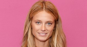 Model Kate Bock Had to Have Her Head Stapled Shut After Rafting Accident