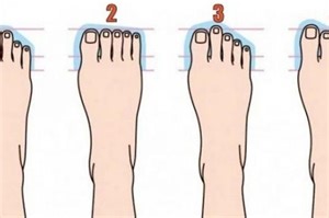 Tes Kepribadian dari Bentuk Jari Kaki, Bisa Ungkap Sifat dan Karakter - Sonora.id