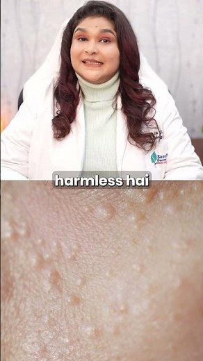 Small Face Bumps That Don’t Respond To Skincare