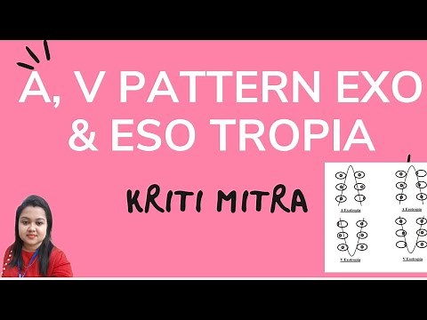 A and V Pattern EXOTROPIA and ESOTROPIA