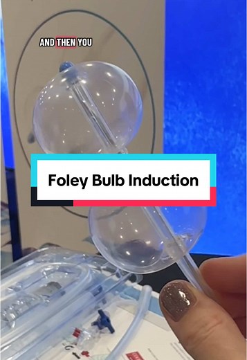 Foley Balloon Induction: A Guide to Labor Induction