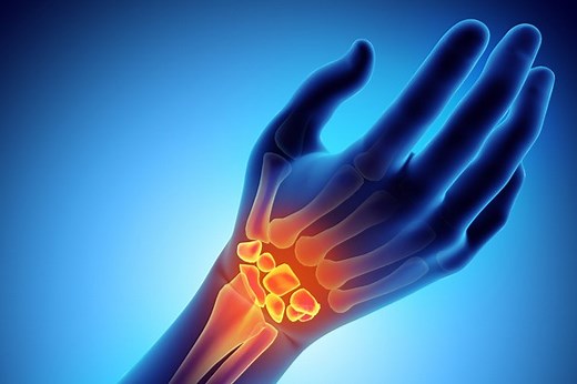Wrist fracture: how to recognise and treat it | Emergency Live