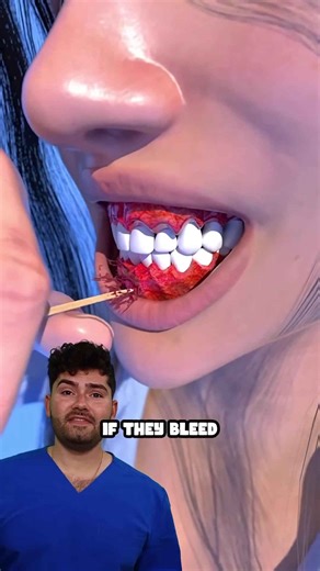 Gum Color Meaning - Dentist Explained