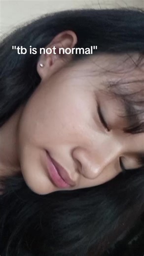 Understanding the Impact of TB: It's Not Normal