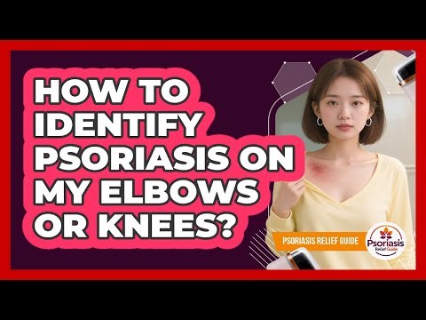 How To Identify Psoriasis On My Elbows Or Knees?