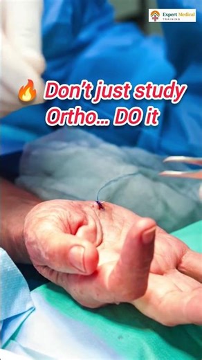 Stop Just Observing! Real Orthopedic Training After MBBS #doctor