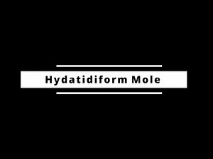 Hydatidiform Mole