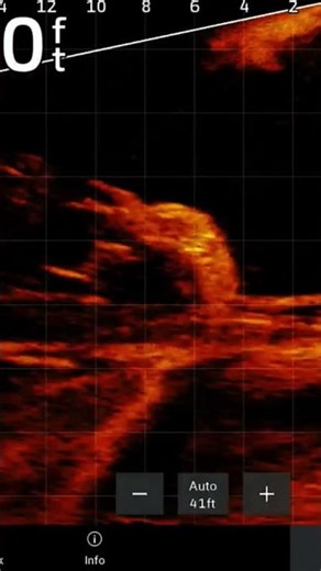 Unexpected Discovery: Car Found in Underwater Tree