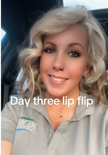 Progress on Day Three of Lip Flip Treatment