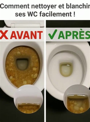 1K views | Comment nettoyer et blanchir ses WC facilement ! (lien en commentaire) | TousPerfect | Facebook