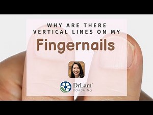 Why Are There Vertical Lines On My Fingernails?