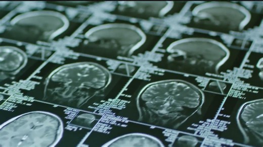 New Framework for Assessing Traumatic Brain Injuries