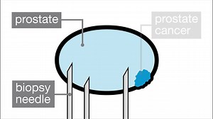 139K views · 1.2K shares | Have you heard the news today about the “biggest leap forward in prostate cancer diagnosis in decades”? Our brand new animation explains how mpMRI could save men’s lives... | Prostate Cancer UK | Facebook