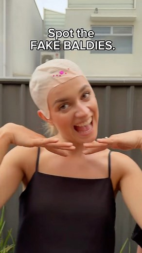 Holly Faller on Instagram: "How many FAKES tried to sneak into my “Bald Only” birthday party?!! 😡😤 #alopecia #bald #baldcap"