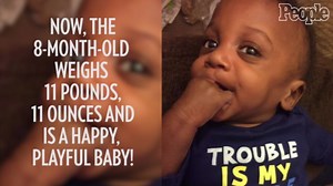 Micro-Preemie Baby Born Weighing 15 Ounces