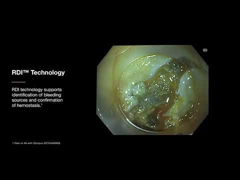 Improve Visibility of Bleeding Points with RDI™ Technology